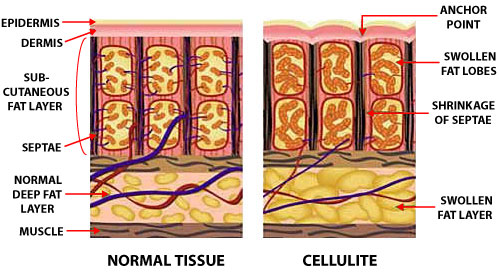 cellulite layers 